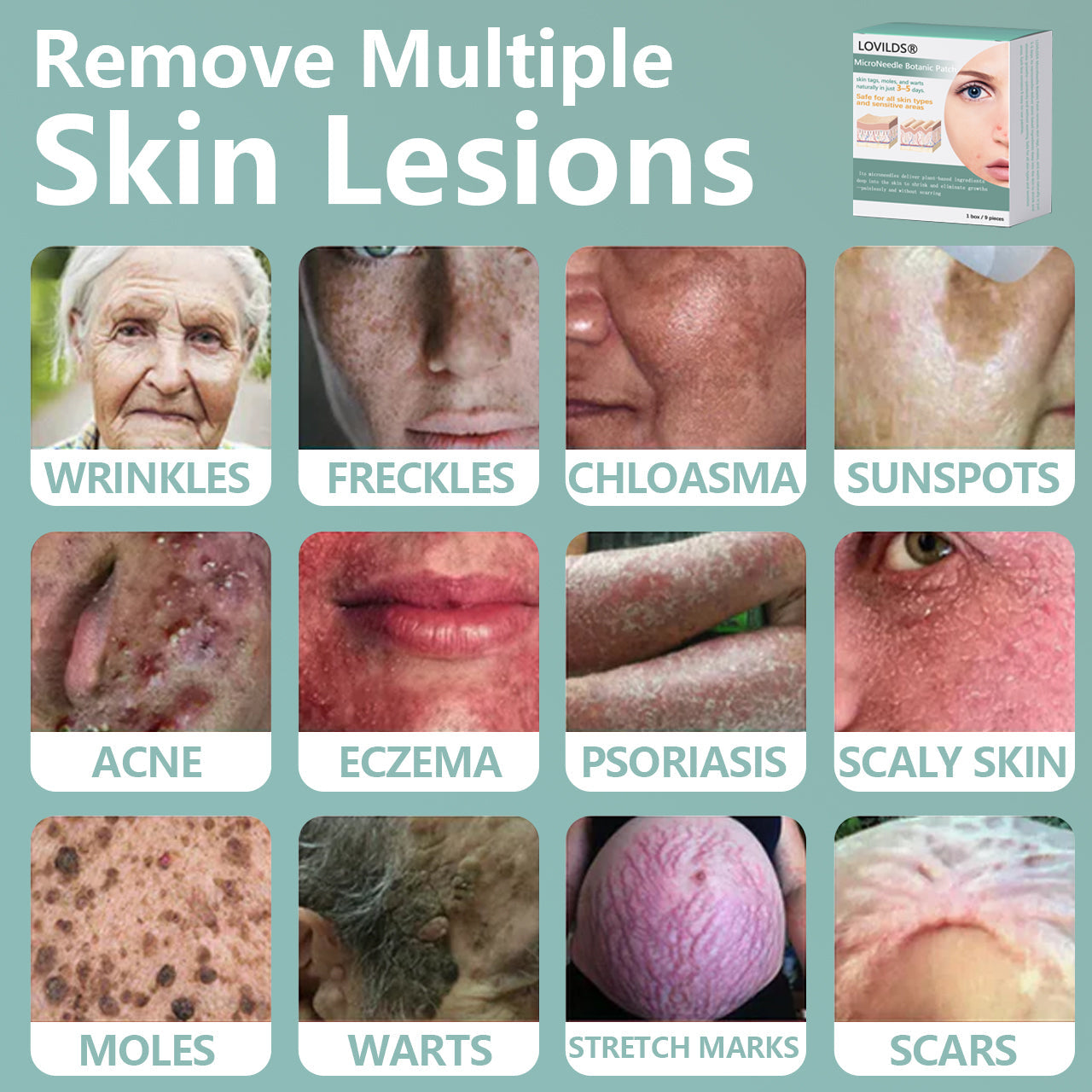 🌈LOVILDS® MicroNeedle Botanic Skin Tag Removal Patch 🇺🇸 Made in the USA