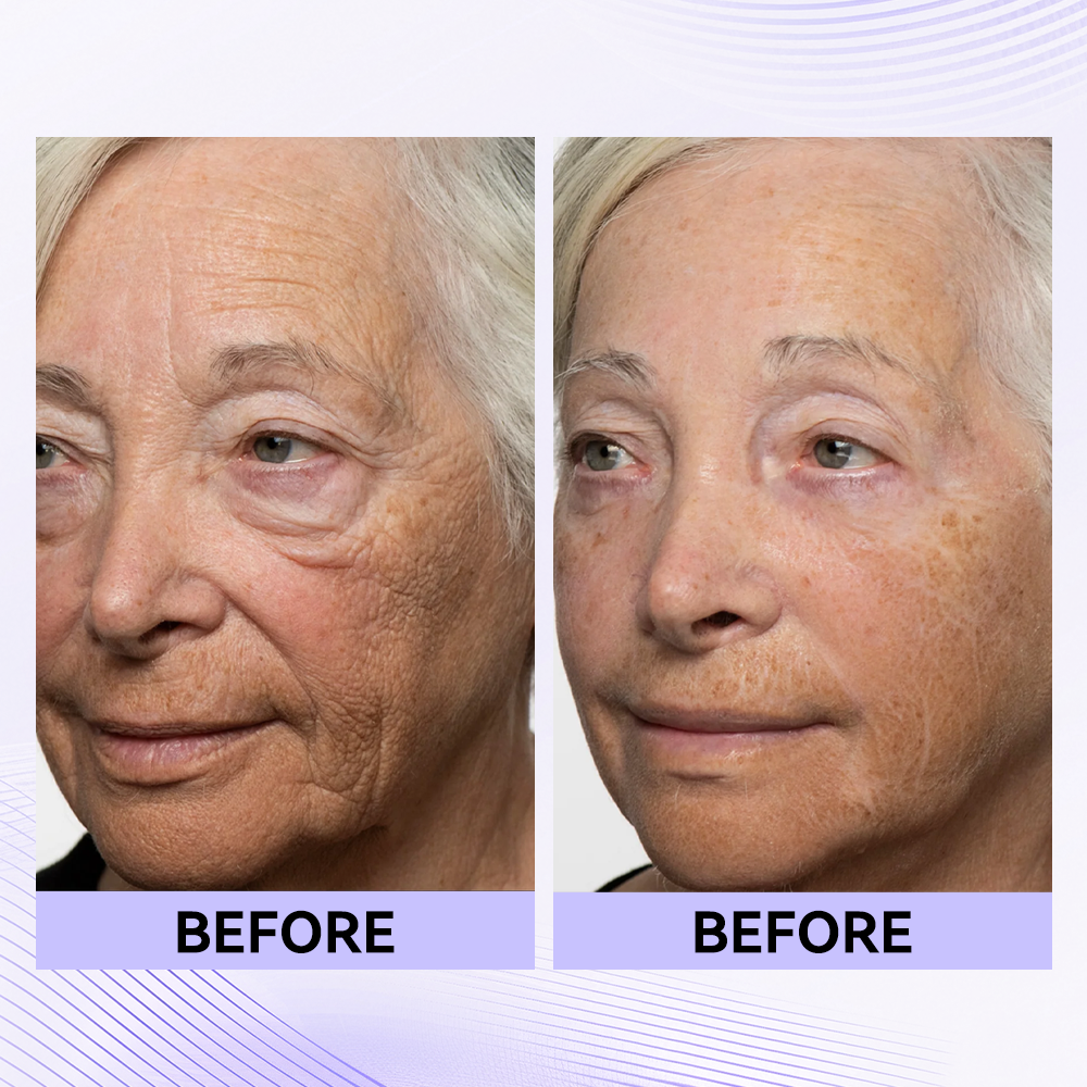 Sale Happening Now:70%OFF🔥 Instant Eye Tightener Easy-Wear Formula With Brush Free!