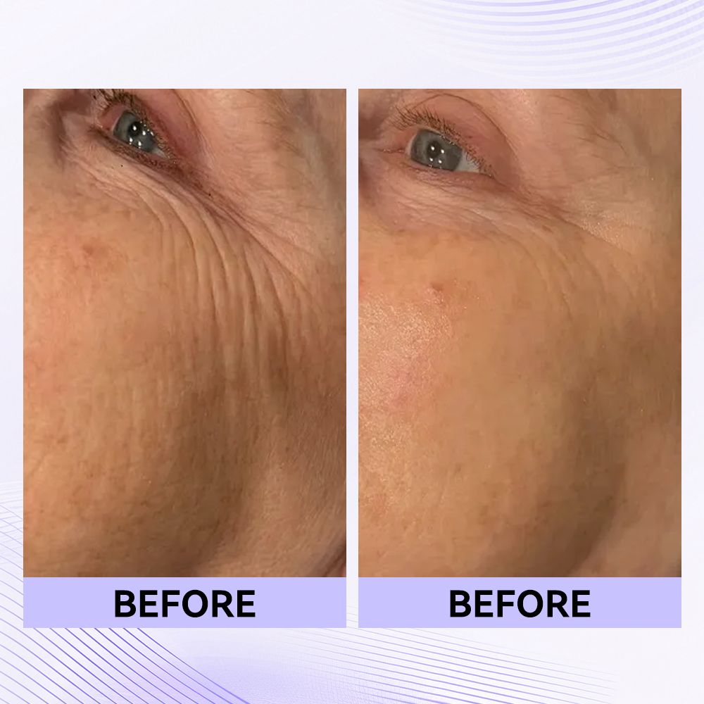 Sale Happening Now:70%OFF🔥 Instant Eye Tightener Easy-Wear Formula With Brush Free!
