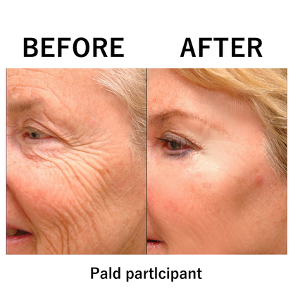 🔥 Last Day Discount: 50% OFF 🌸Instant Temporary Face Tightener