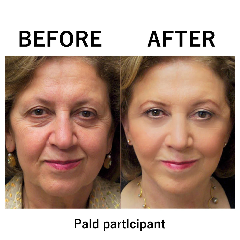 🔥 Last Day Discount: 50% OFF 🌸Instant Temporary Face Tightener