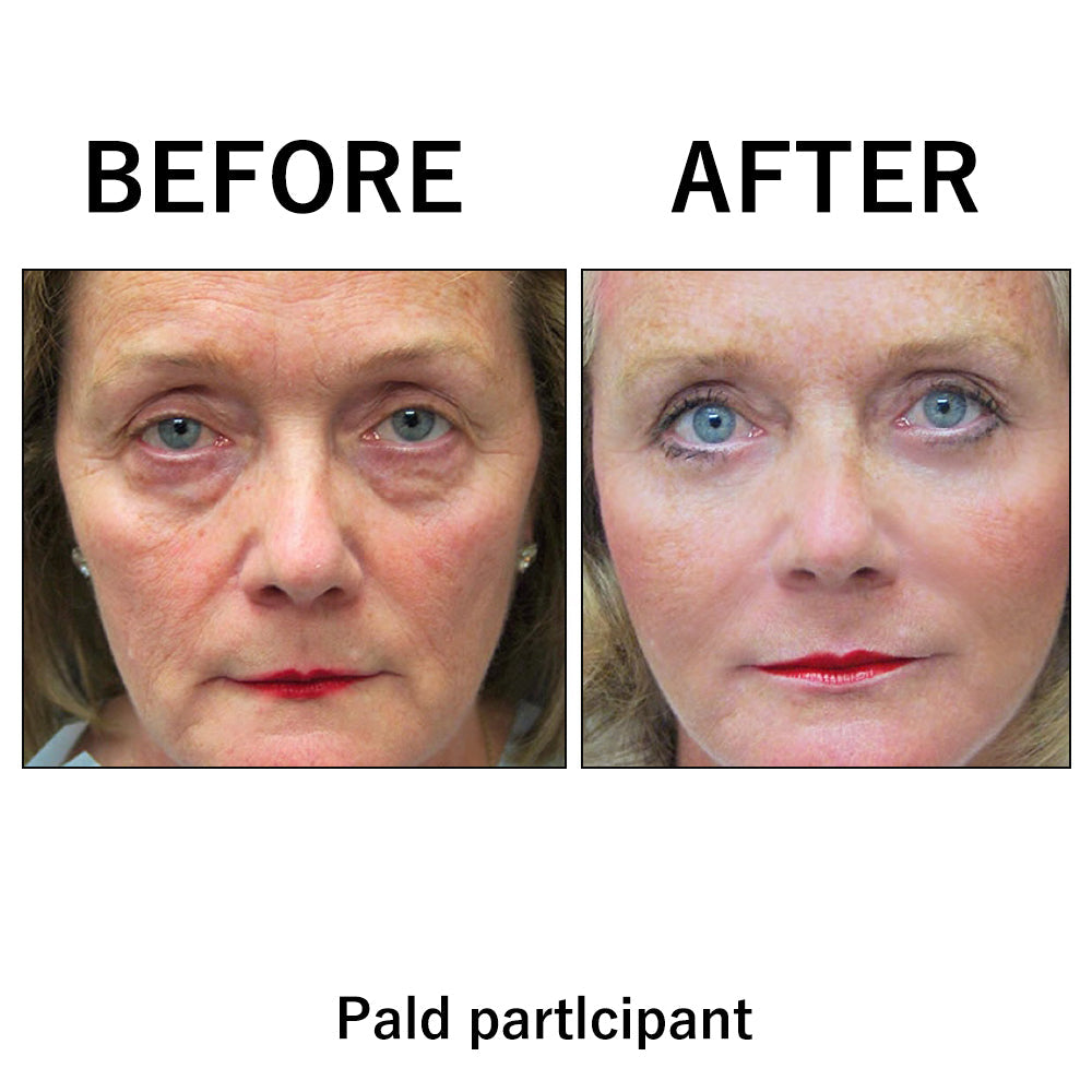🔥 Last Day Discount: 50% OFF 🌸Instant Temporary Face Tightener